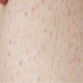 ��ʪ��һֱ��������