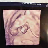 ���Ż�û��˫���ڷ�