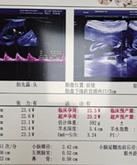 ���Ż�û��̥��˫���ڷ� ���Ӹ�����