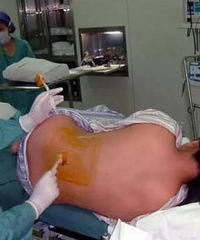 �򲻴���ʹ�� �ͺ������ú͵����Ĳ��