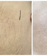 �������������Ƥ ���Ϲ�������