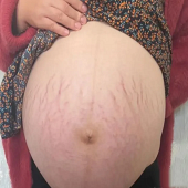 �������Ͷ��ӻ��ǻ���