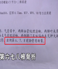 ���꺢���ز���ʹ û�뵽����3���߹�