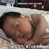 抑菌霜激素严重超标