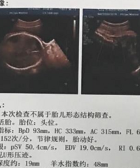 ��������ӻ��� ���һ�����������