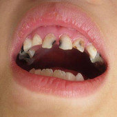 ���Ӳ������������