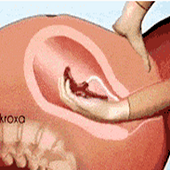 �ְ�̥�̿��Ŷ�ʹ