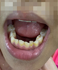 ���ӻ����� ����ͻȻ���������