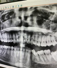 ������Ҫ���ǳ��𣿲��λ��к�᲻����Ӱ��