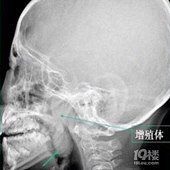 ������ʱ�����ռ�