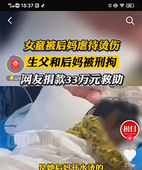 后妈真毒啊,嫁过来一个月就把4岁继女打终身残疾了