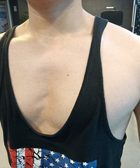 93���� ������174����75  �ҽ����� ��ֵ����Ϊ6-7��