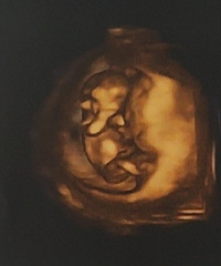 ��ĸ��̫������ ���п�ʼ���ֲ���� �з�ʲôʱ�����ѽ