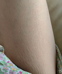 ���꺢�ӵĺ���֢���� ��Щ������Ӧ����ô����������