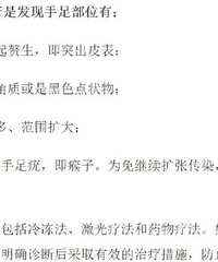 10���к�����Ӿ�νŵ׳���С����ҽ������Ⱦ��HPV