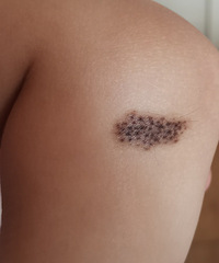 ����̥����Ҫȥ���𣿺��Ӻ����� ��Ϊ��ë��...