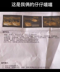 ��ο������ԺŮ�о�����ѧ�����������ǳ���ѧ��160������ʦ