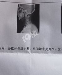 ƫͷʹ�þ��� ���챻��֪˵�Ǿ�׵�����ˡ���Ҫ���� �Ĺ��찡