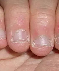 ������ҧָͷ��ϰ�� �úõ���ҧ�Ĳ�����Ŀ �������������⣿