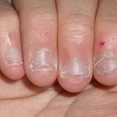 ҧ��ָҧ��һ����Ϳ