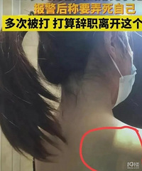 ���˿����߶�ϱ������������  ����ʵľ��ʾ�����ϱ������