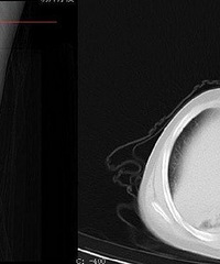 12���к�����һ�ܲ���ҽ�ɡ��׷Ρ� ר�ң��⼸�������Ӳ��