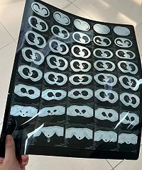 [����]CT����������������˶�˵�߷����Ҫȥ�����