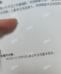 �¹ڷ������츴�飬���յĲ����