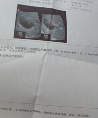 专家的说孕妇感染新冠对孩子没有影响 但我看到好几个胎停的