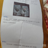 �и����˶�����Ӱ����