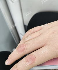 С��Ƥ�����ö����� ����Ƥ���ƿ��˸���һֱû����