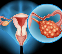 �����ѳ��ۺ��� ���ݳ�������ô�죿