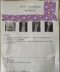 ȥ����Ƭ�����ű��浥 ����һ���շ�16Ԫ���ǵģ�8Ԫ/�ţ�