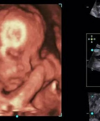 ��ά�ܿ�������������һ����һ�� ��ô�����ϴ�...