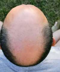 ���ֺö������˻�û������Ϳ�ʼͺ���Ͱ׷� ���������ĸ���