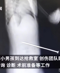 һ��û��ס �޾������ˣ��������޷�ʽ �����ȫ����Ҫע��