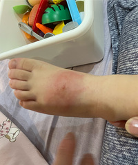 �������Ӱ����׸�Ϳʲô����ҧ��Ƥ����Ӧ�ܴ�...