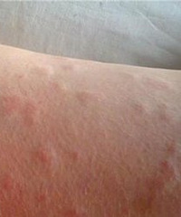 ����������С��ݡ���� �����ĸ�ҽԺ������ȽϺã�