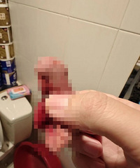 Ů��˳����Ժ���ų���Ѫɴ�� ������ҽ��ί�ѽ���