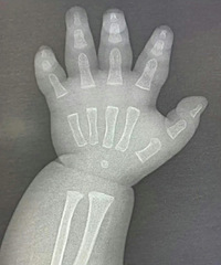 ԭ��X���µ�Ӥ��С�ֳ�������̫�ɰ��˰ɣ�