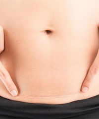 �ʸ��� ���ǵ����������ű�������ô��