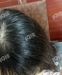 ���������������û��Ϊ��������ͷͺor�ѷ���ҽ���Ƽ���