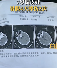 С������ĺõ�Ƥ��7����ͯ���4��ˤ��2�Ρ��ҳ�Ҫ�������ɣ�