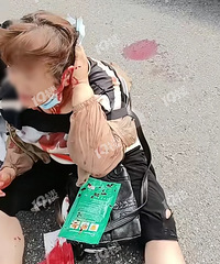 ƽ��һ�������СŮ�����ƿ���������ˣ�ˤ��ͷ��Ѫ����