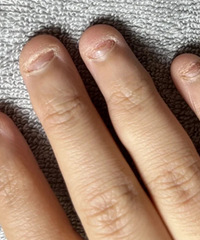 ��������ô���޽����ָ�ף��Ѿ��е�ָ�׶��Ҳ��̶���