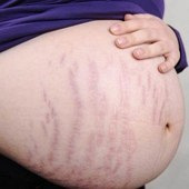 ����ǰ��ı仯