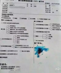 ����ϸ��TCT���浥���½����ȫ һ�������ף�