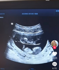 �μ��߾��ǻ����ˣ��������̥�����μ���ʲôѽ��