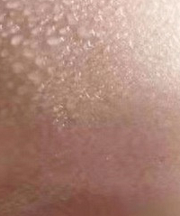 ���ӳ�������ȱ����