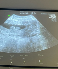 �����ھͿ�ʼ©��Ľ��ã�����һ̥���Ƕ�̥ѽ����ô�����ģ�